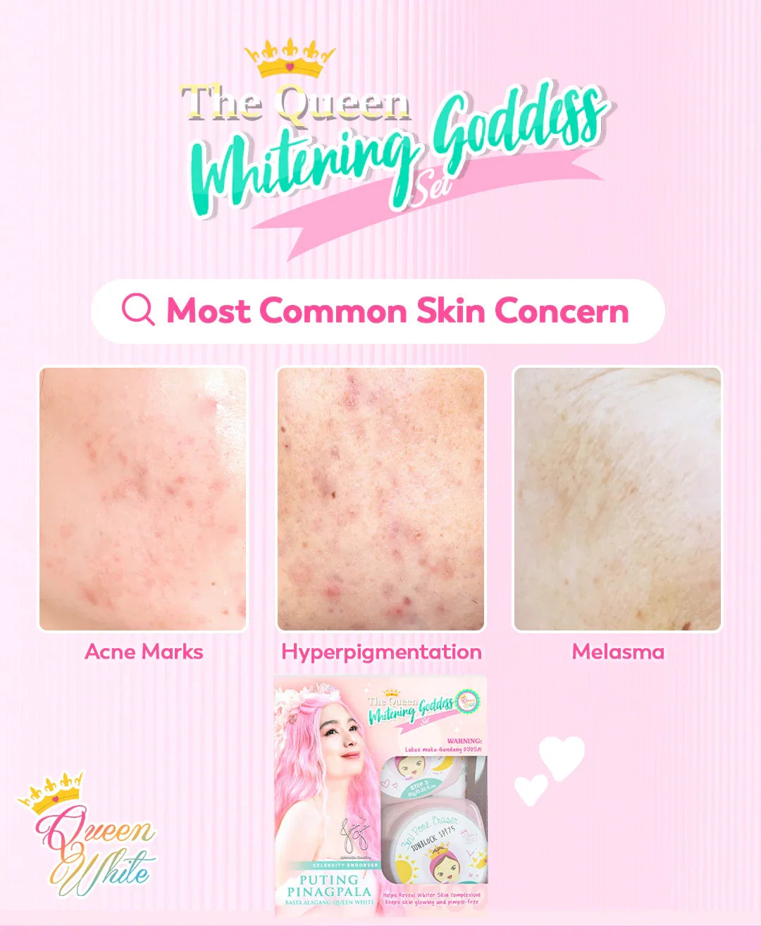 The Queen Brightening Goddess Set