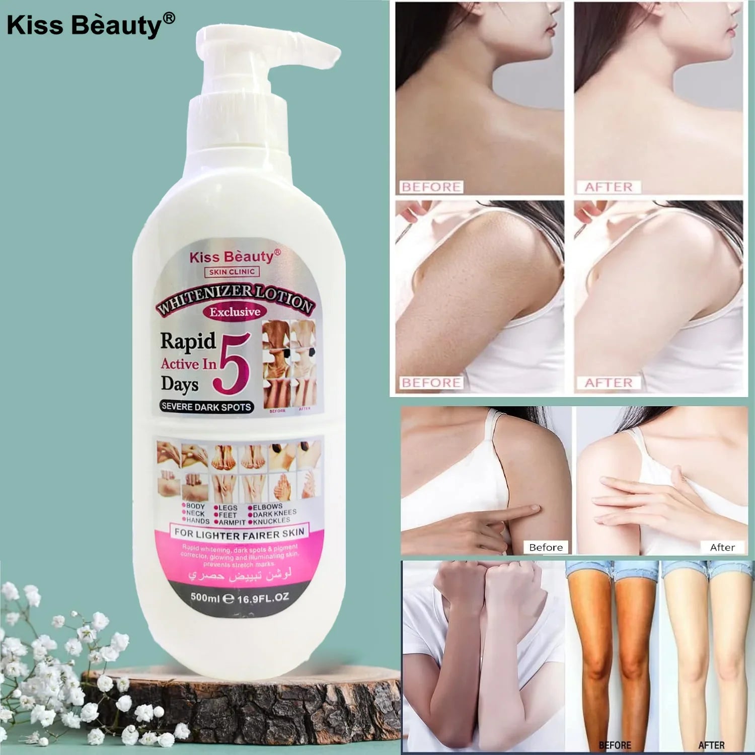 Kiss Beauty Whitenizer Lotion - 500ml