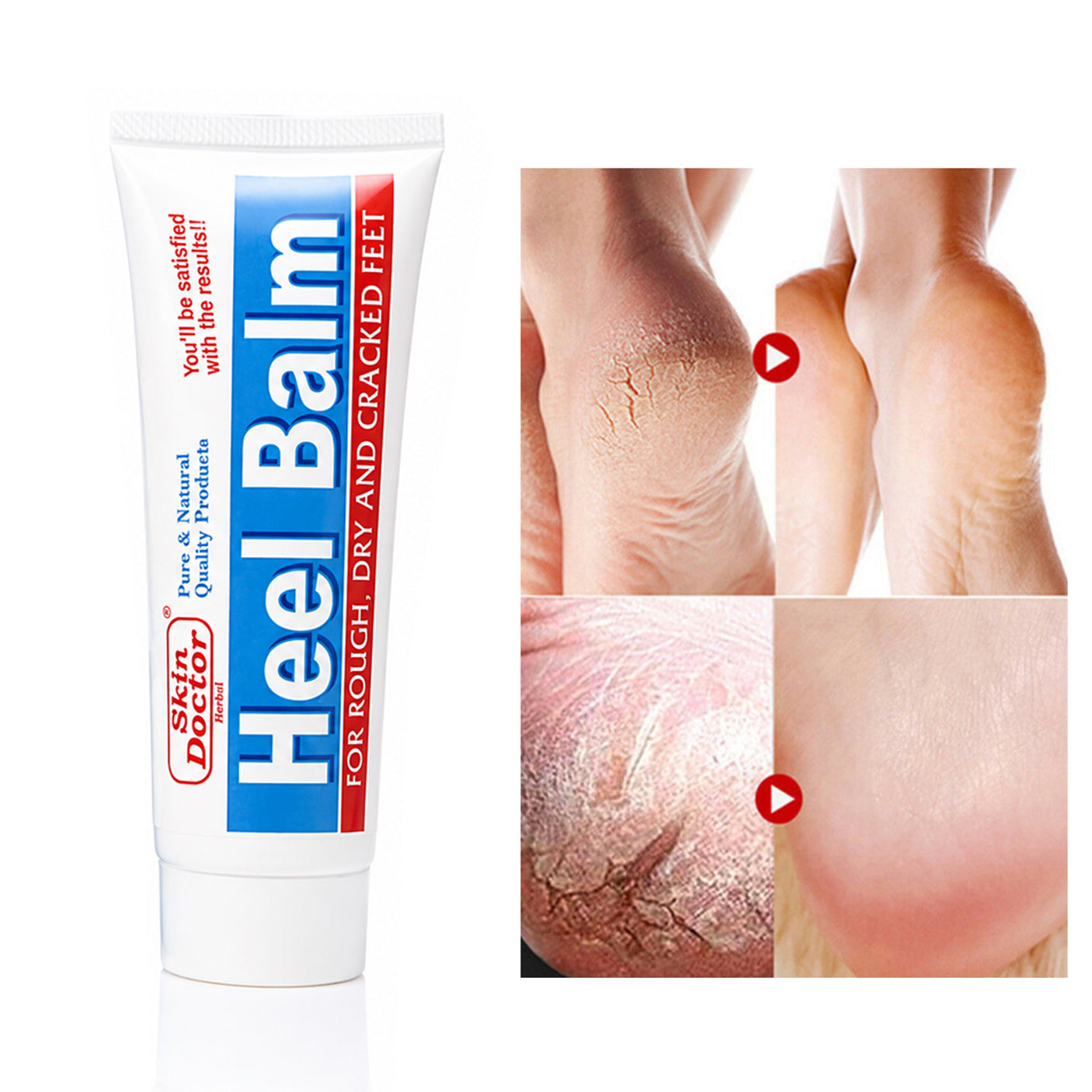 Skin Doctor Herbal Foot Heel Balm - 50ml