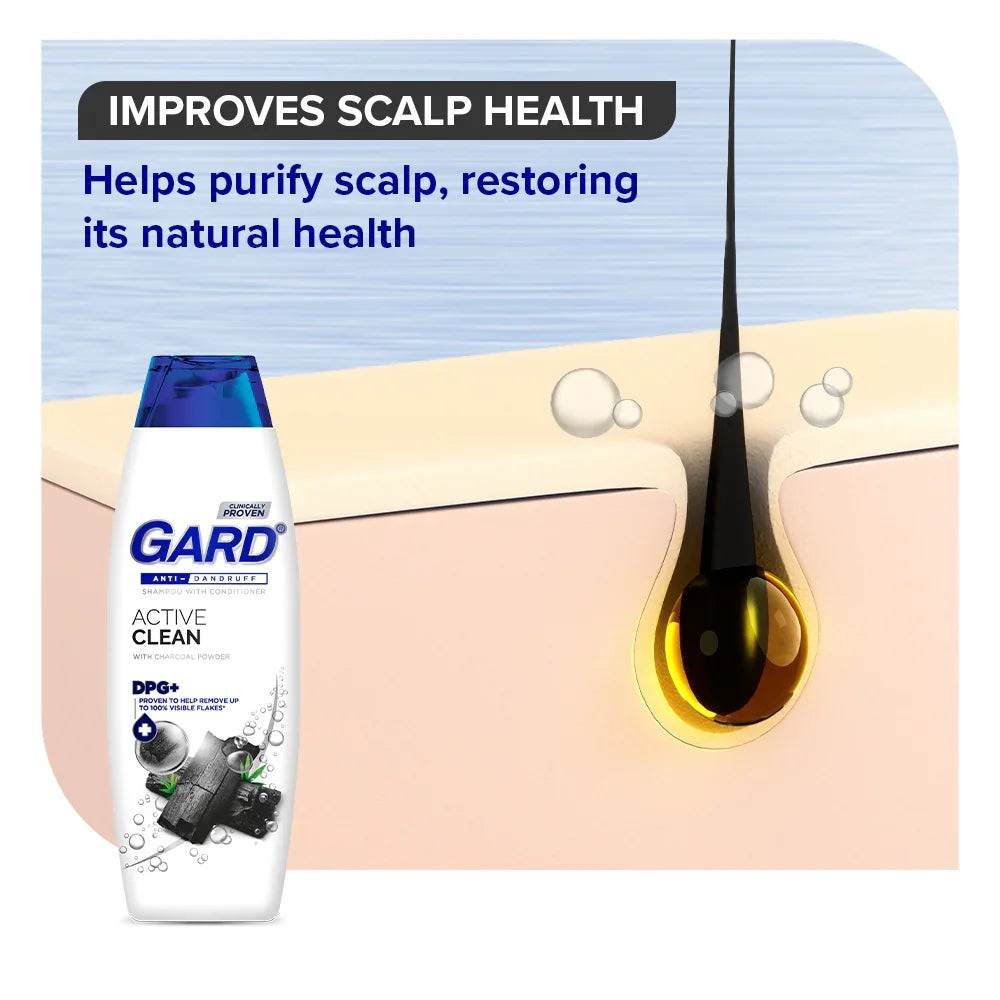 Gard Anti-Dandruff Active Clean Shampoo - 170ml