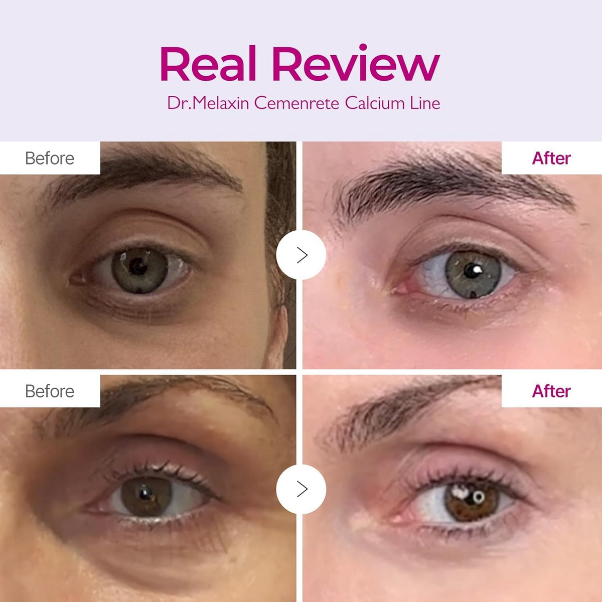 Dr.Melaxin Cemenrete Calcium Volume Face Cream - 50g