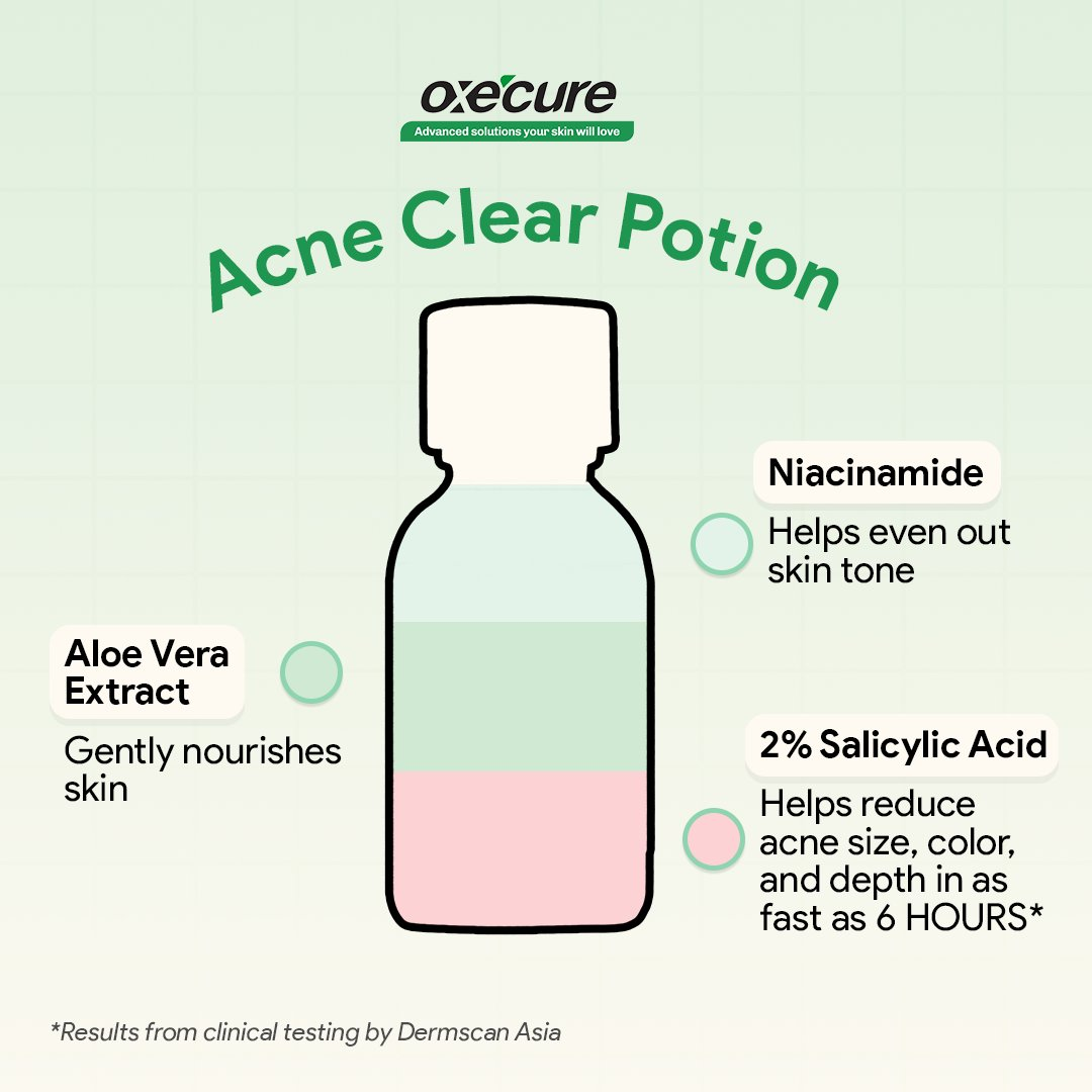Oxecure Acne Clear Potion - 15ml