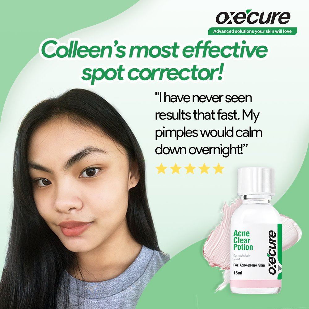 Oxecure Acne Clear Potion - 15ml