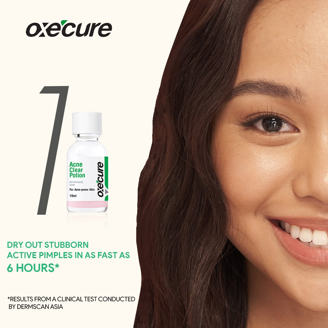 Oxecure Acne Clear Potion - 15ml