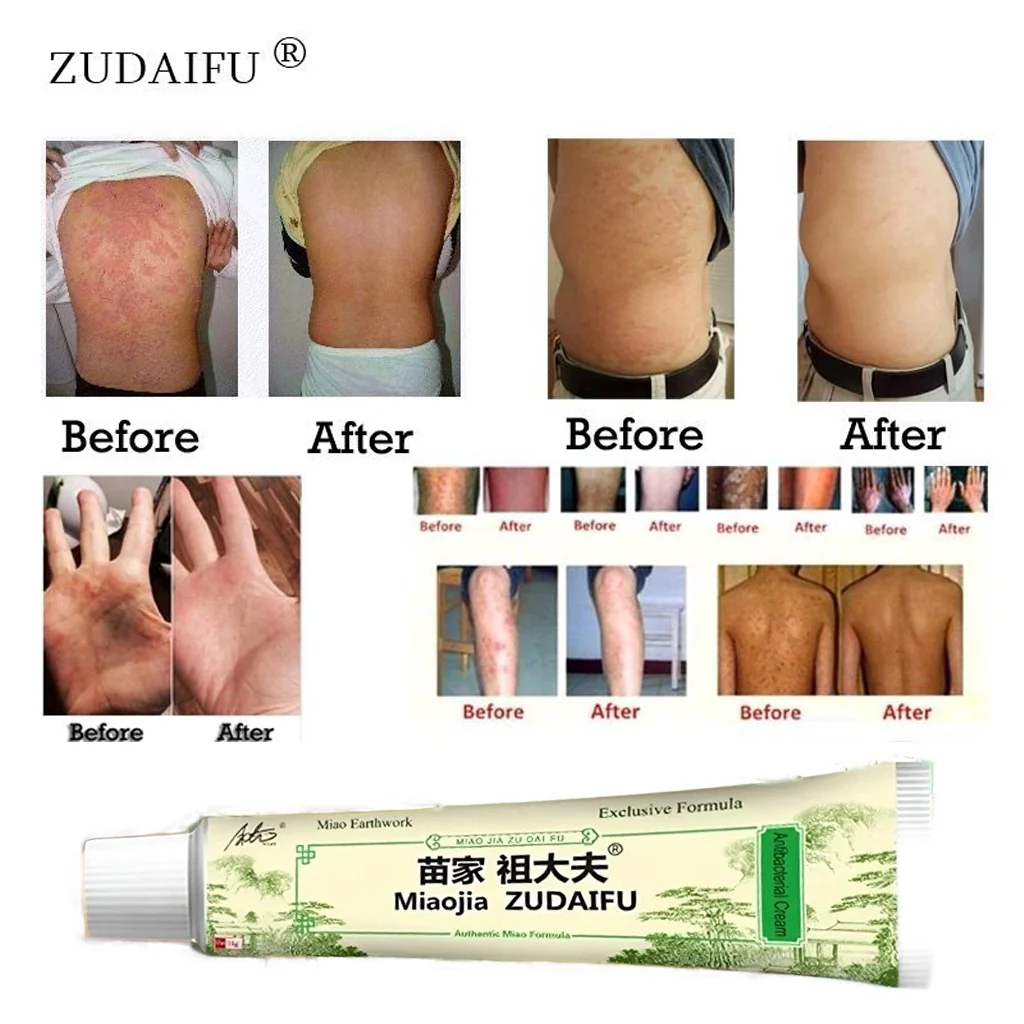 Miaojia Zudaifu Chinese Moisturizing Soothing Cream - 15g