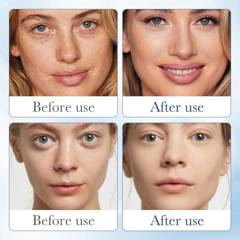 Sadoer Hyaluronic Acid Anti-Aging Serum - 100ml