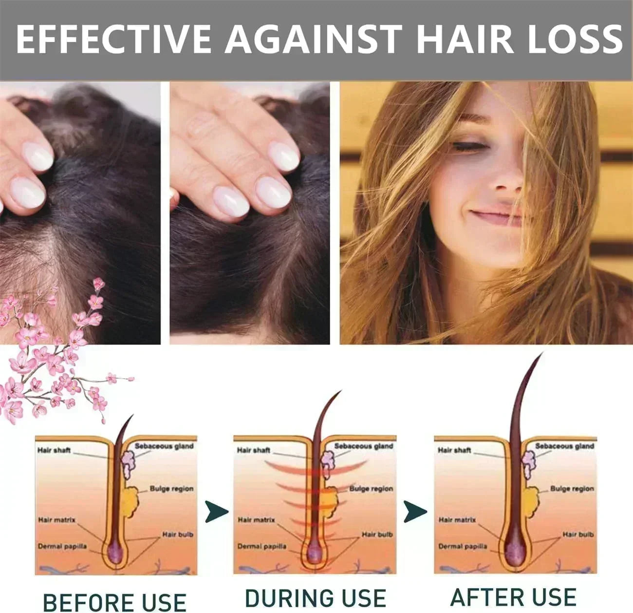 Maxfit Hair Growth Sakura Japanese Conditioner - 300ml