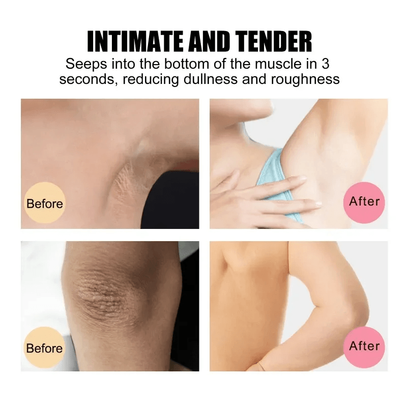 EELHOE Dark Spot Remover Brightening Soap - 100g
