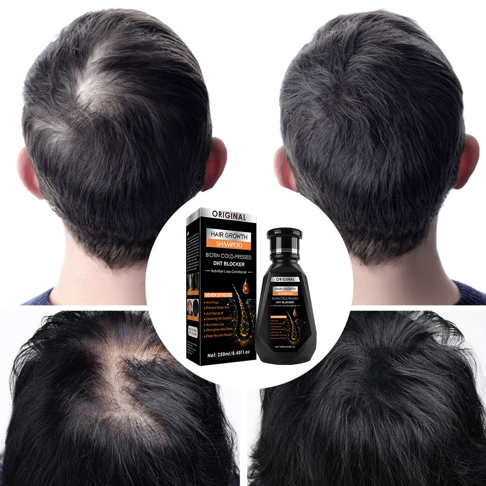 Formbo Original Hair Growth Shampoo DHT Blocker - 250ml