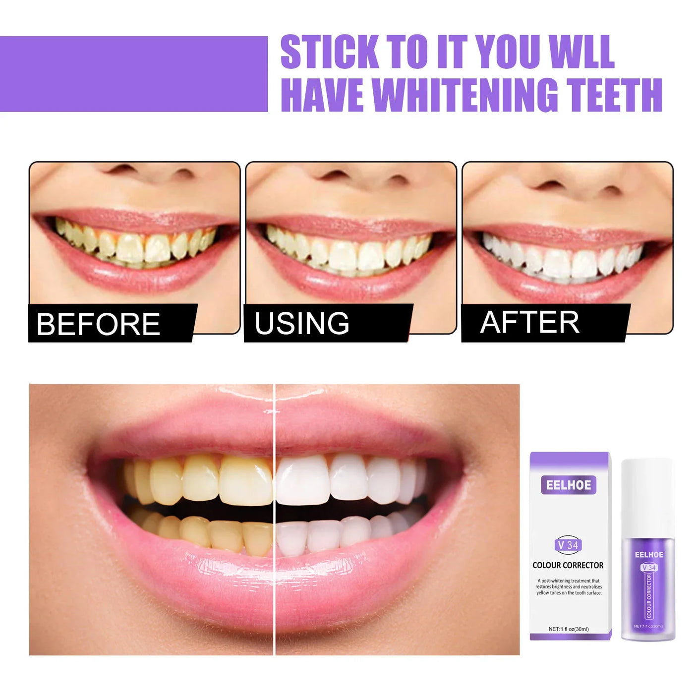 مصحح الألوان EELHOE V34 مصحح اللون + طقم العناية بالمينا NH pro Enamel Care - 30 مل × 2 قطعة