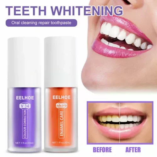 مصحح الألوان EELHOE V34 مصحح اللون + طقم العناية بالمينا NH pro Enamel Care - 30 مل × 2 قطعة