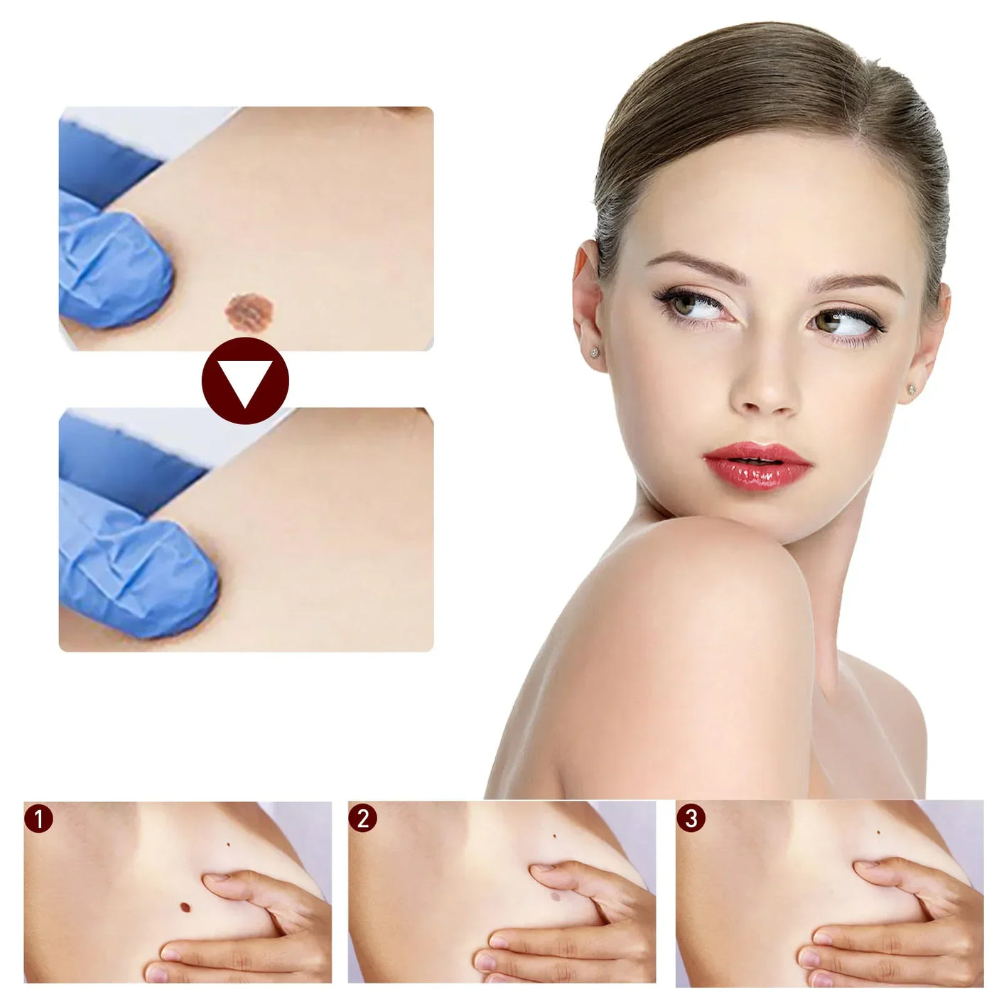 جايسونغ سائل لإزالة الثآليل المسطحة - 3 مل