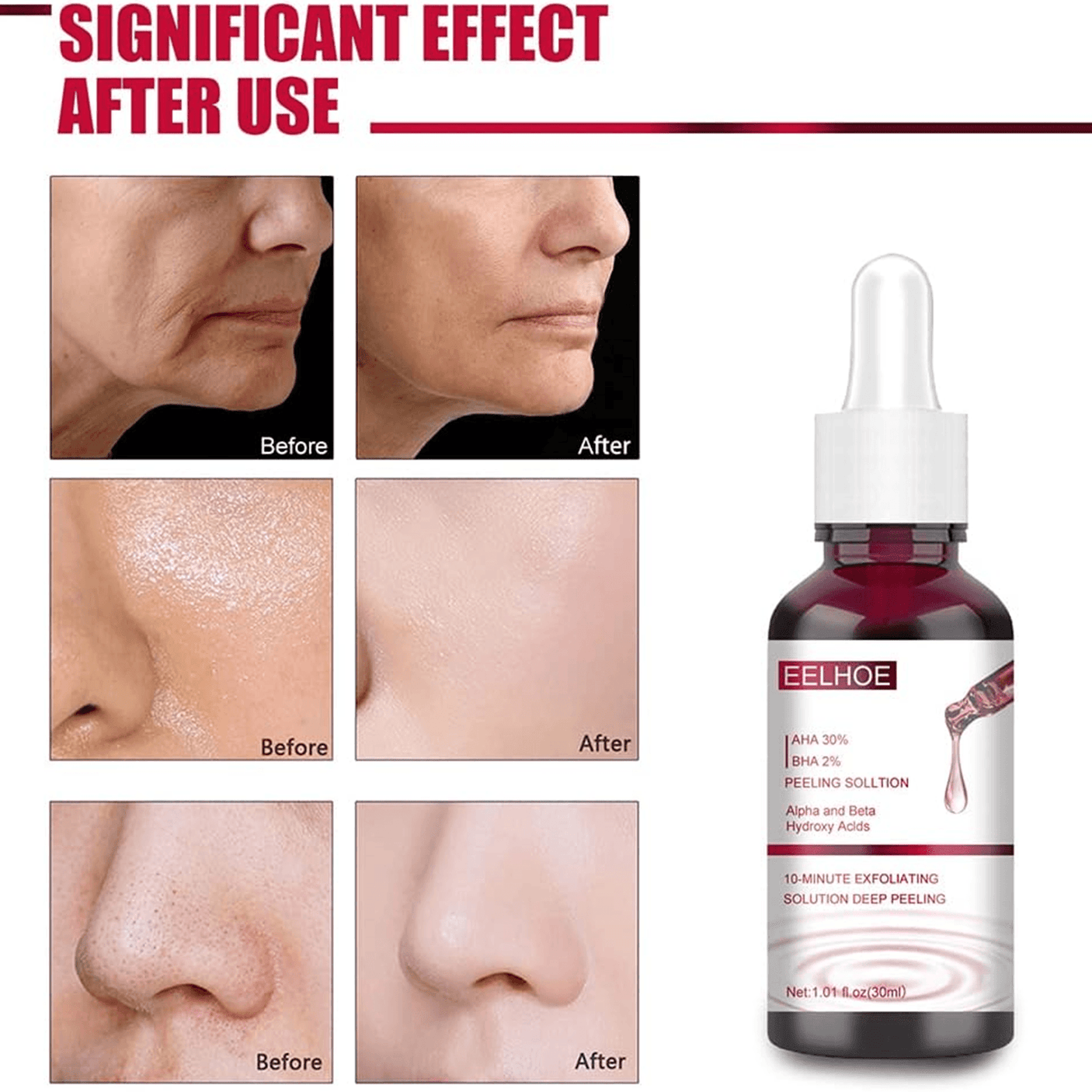 EELHOE AHA 30% + BHA 2% Peeling Solution - 30ml