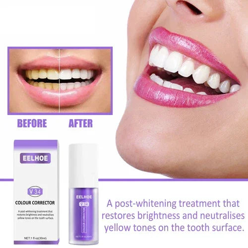 مصحح الألوان EELHOE V34 مصحح اللون + طقم العناية بالمينا NH pro Enamel Care - 30 مل × 2 قطعة