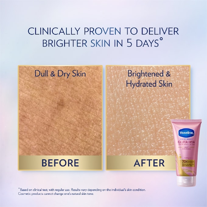 Vaseline Gluta-Hya Serum Burst Lotion Dewy Radiance 70X - 300ml
