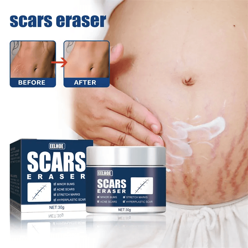 EELHOE Scars Eraser - 30g