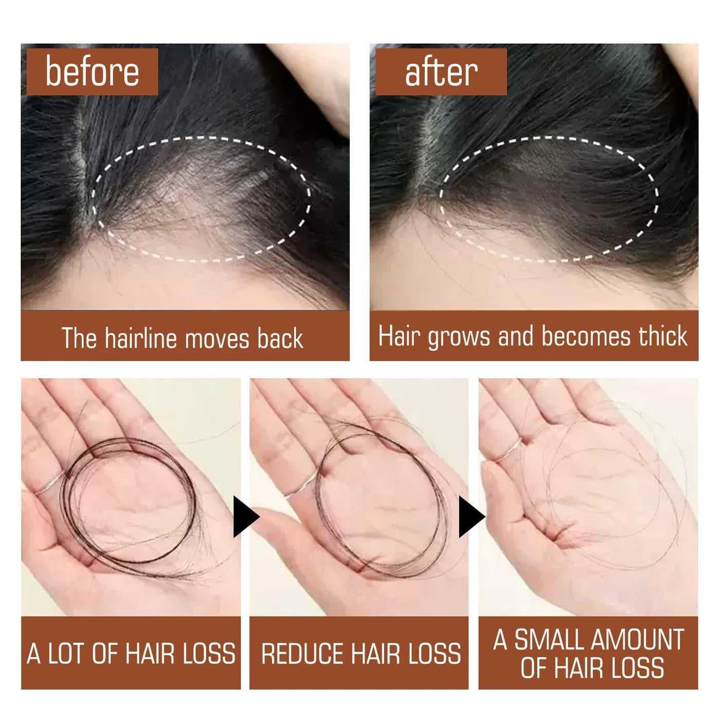 Eelhoe Batana Oil For Revitalized Hair Growth & Strength - 120ml