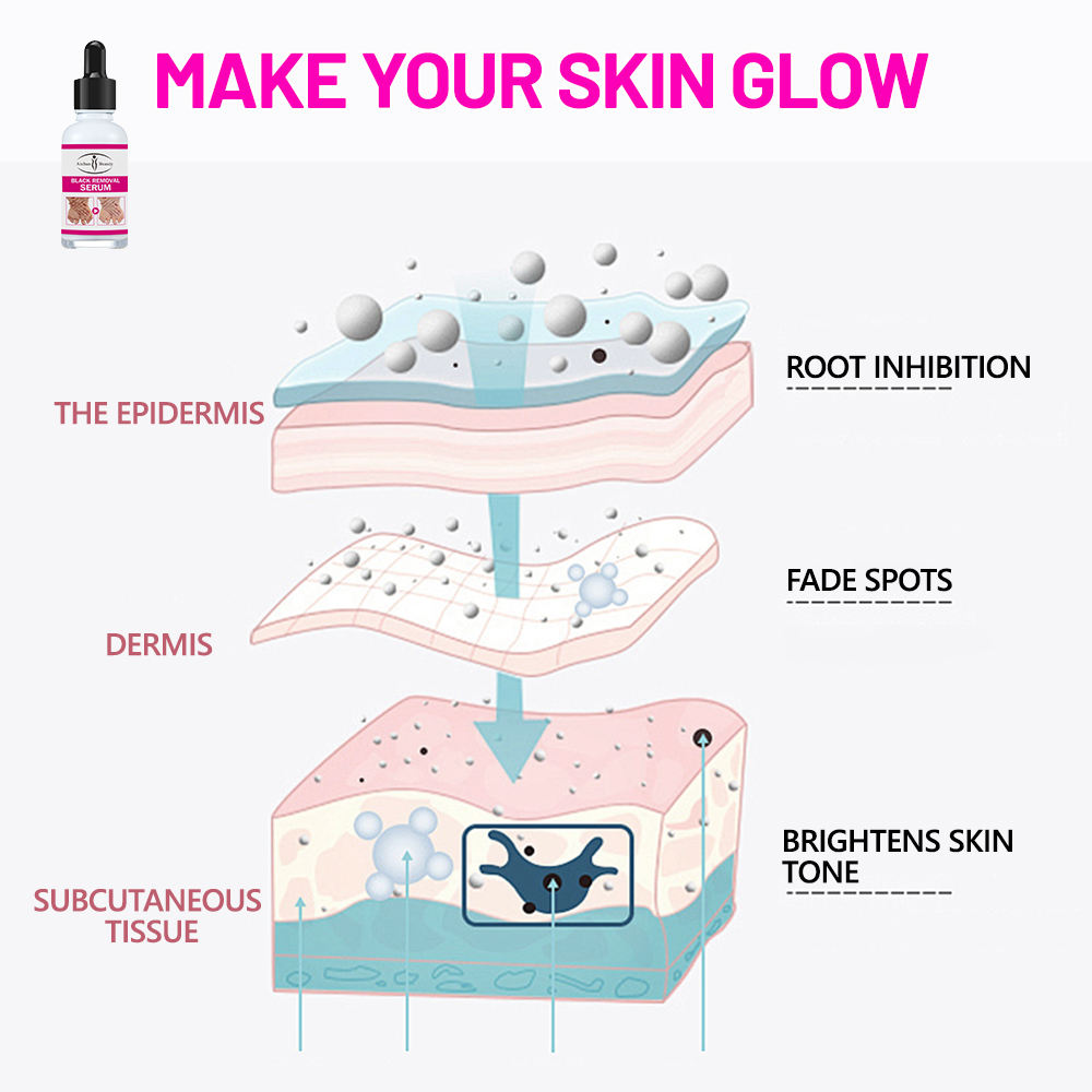 Aichun Beauty Elbow & Knee Brightening Serum - 30ml