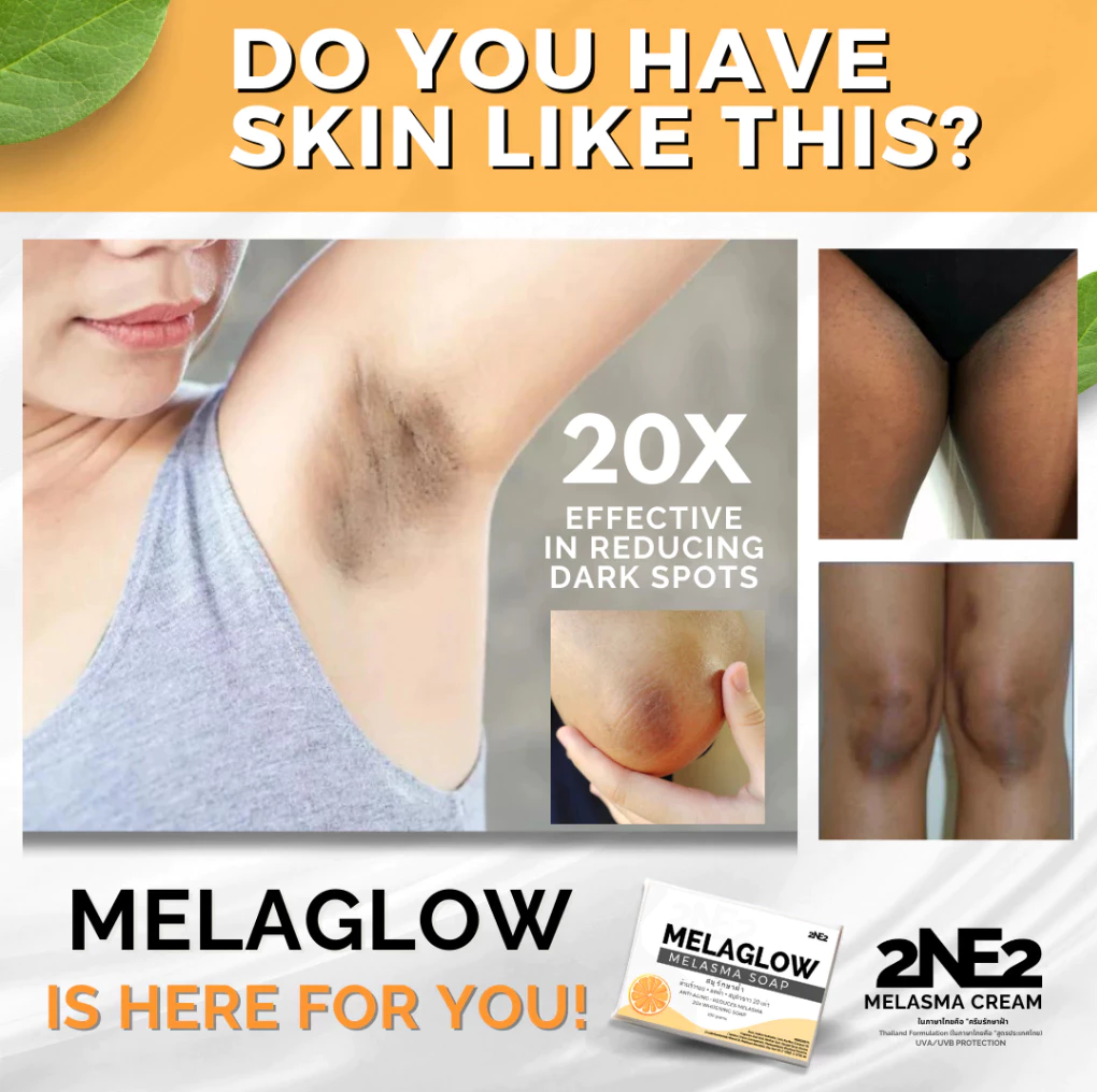 2NE2 MelaGlow Melasma Soap - 100g