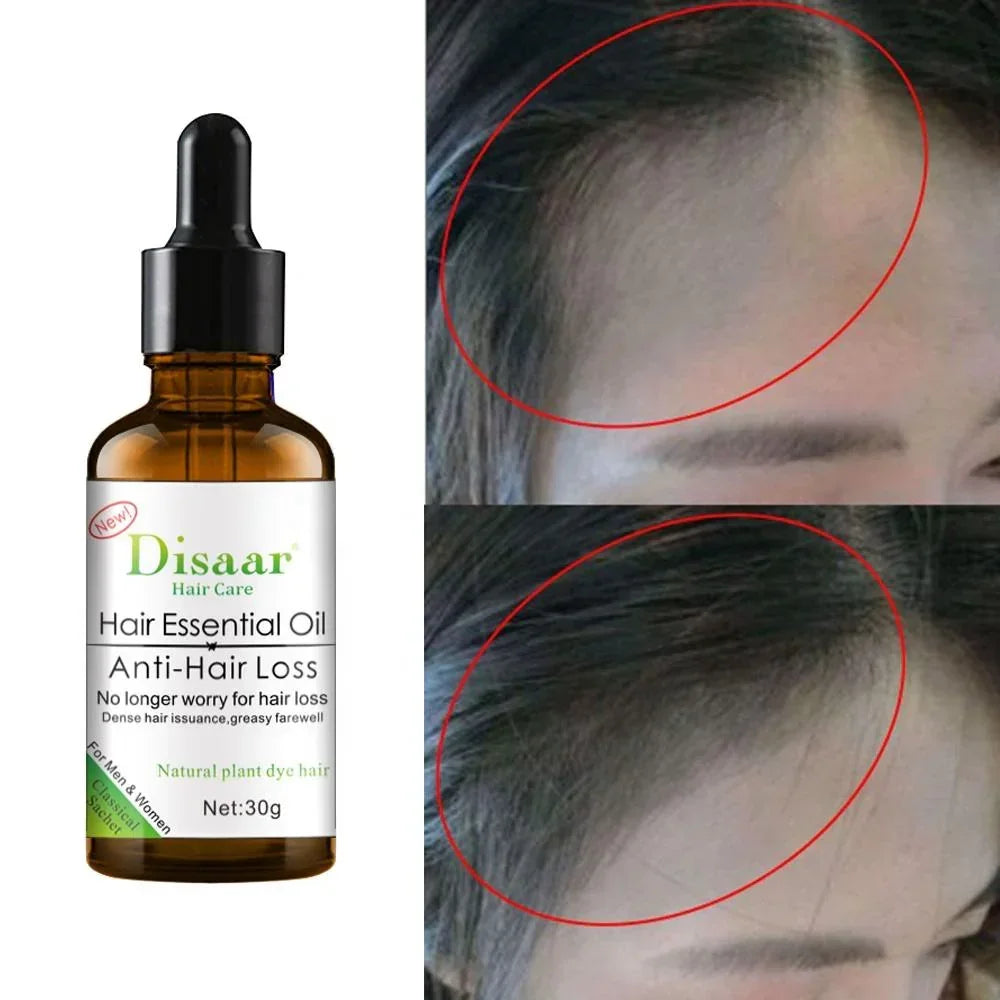 Disaar Anti-Hair Loss Shampoo + Oil - 200ml + 30g