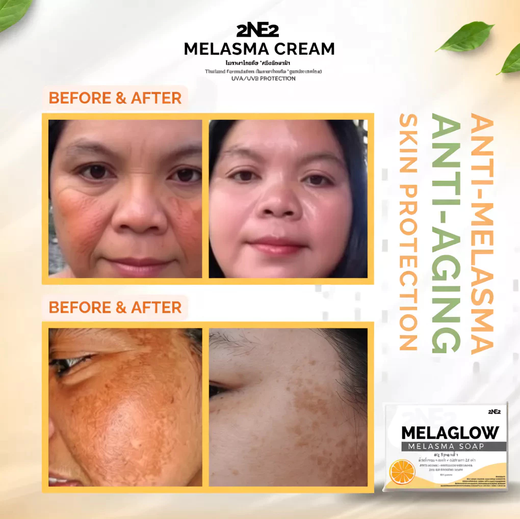 2NE2 MelaGlow Melasma Soap - 100g