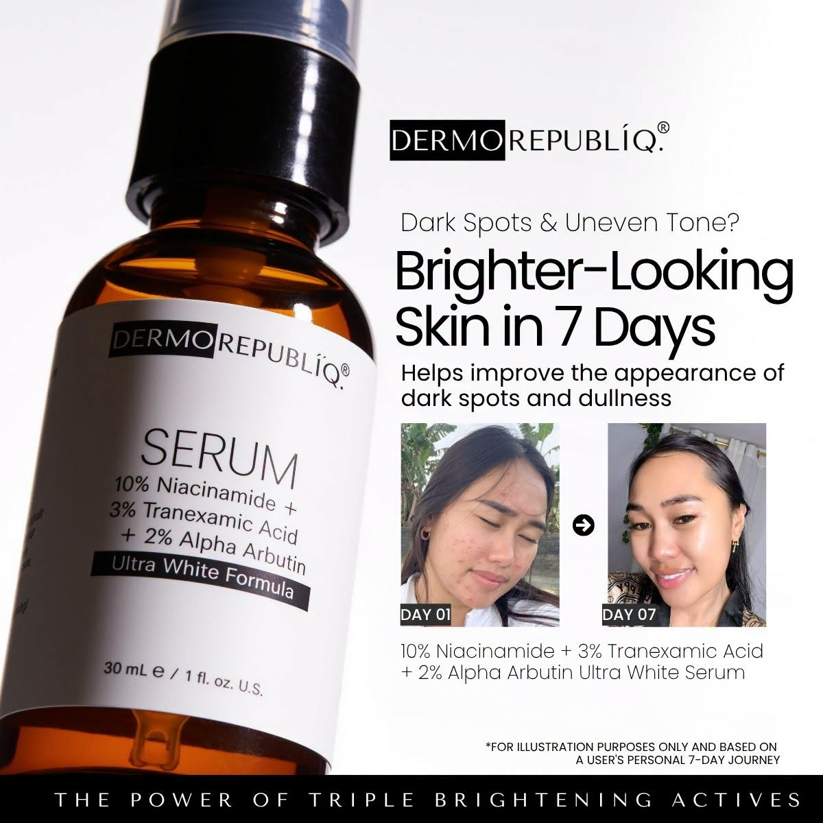 Dermorepubliq 10% Niacinamide Ultra White Formula Serum - 30ml