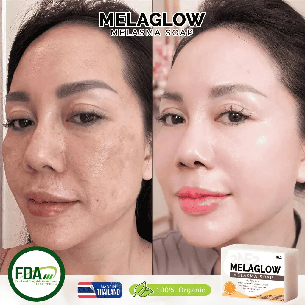 2NE2 MelaGlow Melasma Soap - 100g