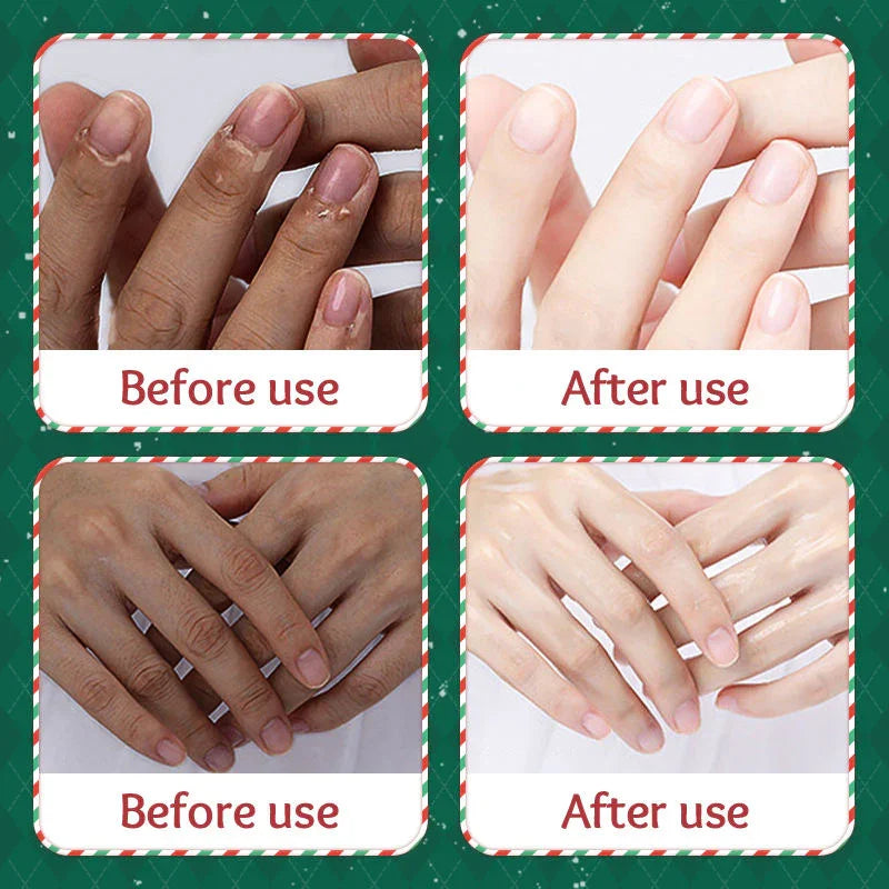 Sadoer Exfoliating & Brightening Hand & Foot Mask - 35g × 2 Pcs