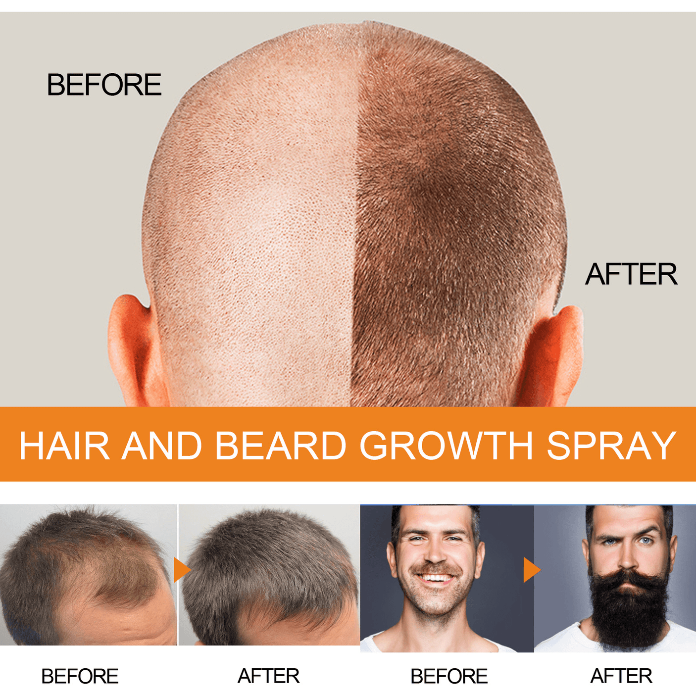Jaysuing Hair & Beard Growth Spray - 100ml
