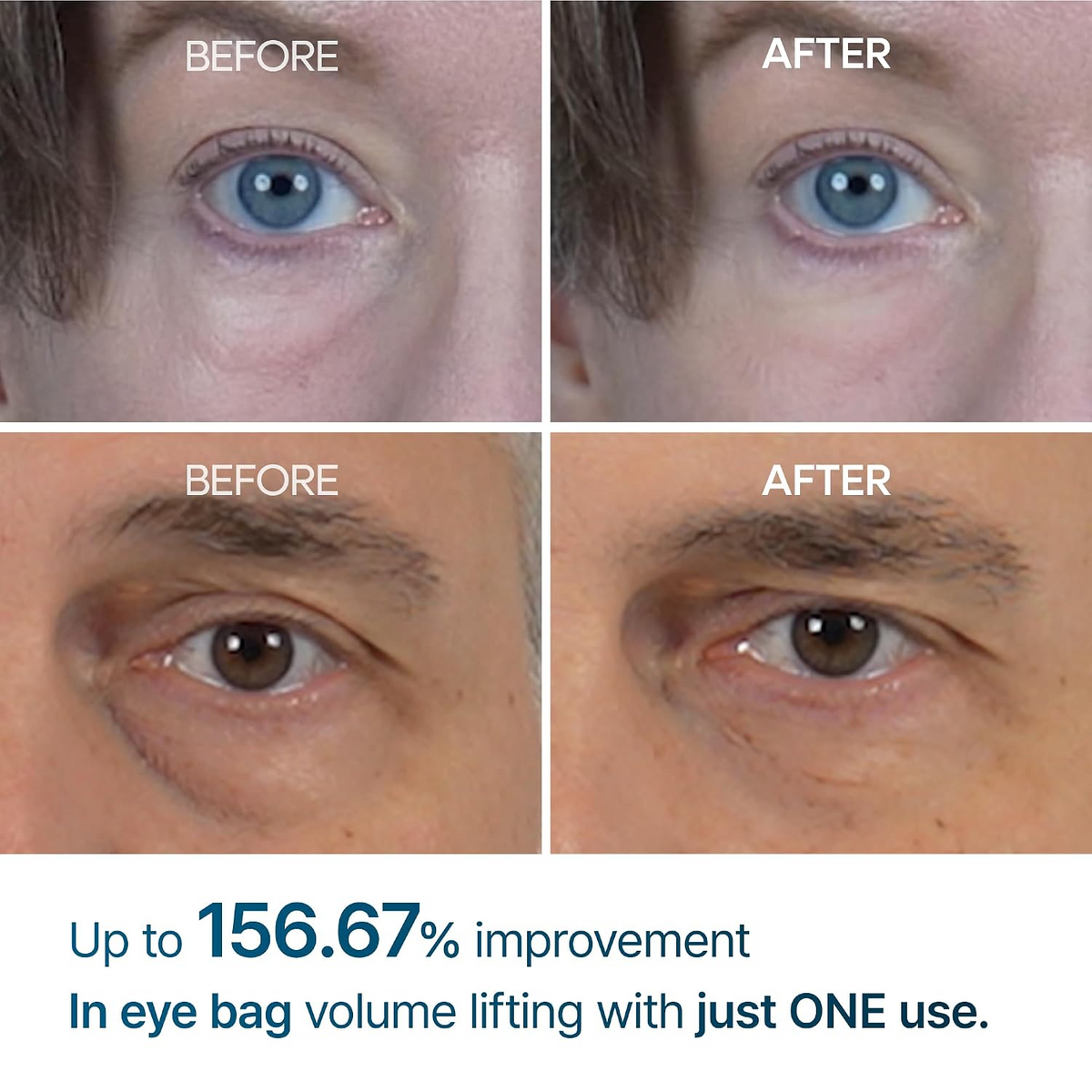 Dr.Melaxin Eyephalt Eyebag Cream - 10g