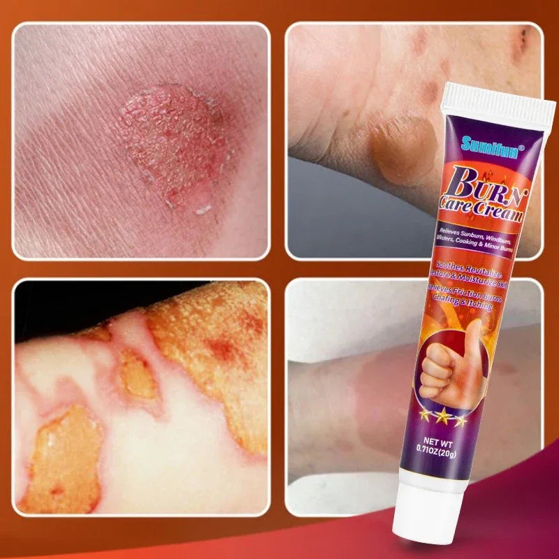 Sumifun Burn Care Cream - 20g