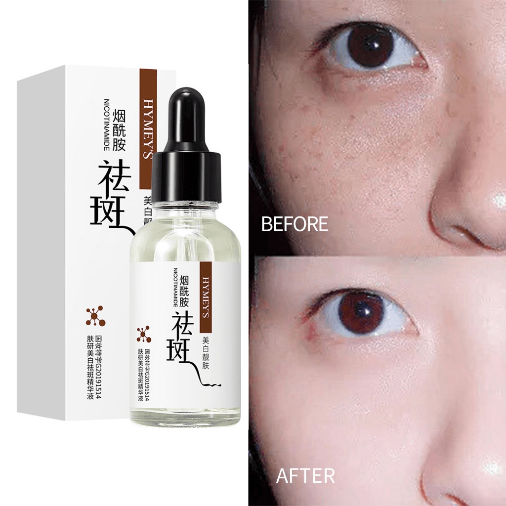Hymey's Nicotinamide Anti Freckle Face Serum - 30ml