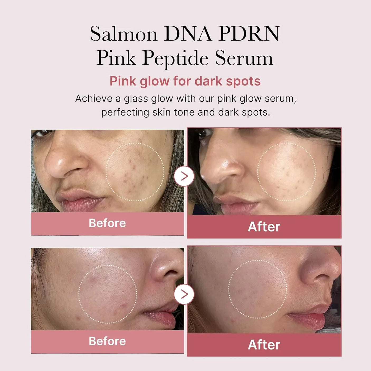 Medicube PDRN Pink Peptide Serum - 30ml