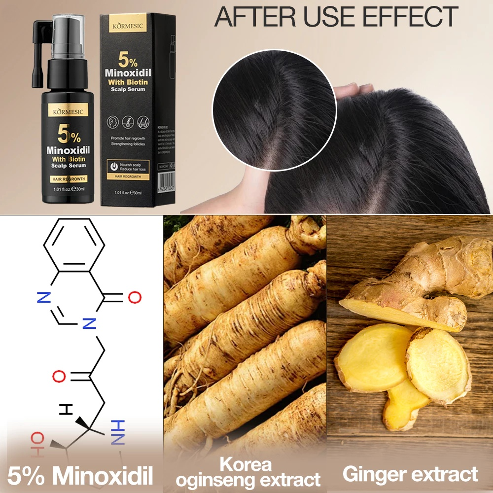 Kormesic 5% Minoxidil With Biotin Hair Regrowth Serum - 30ml