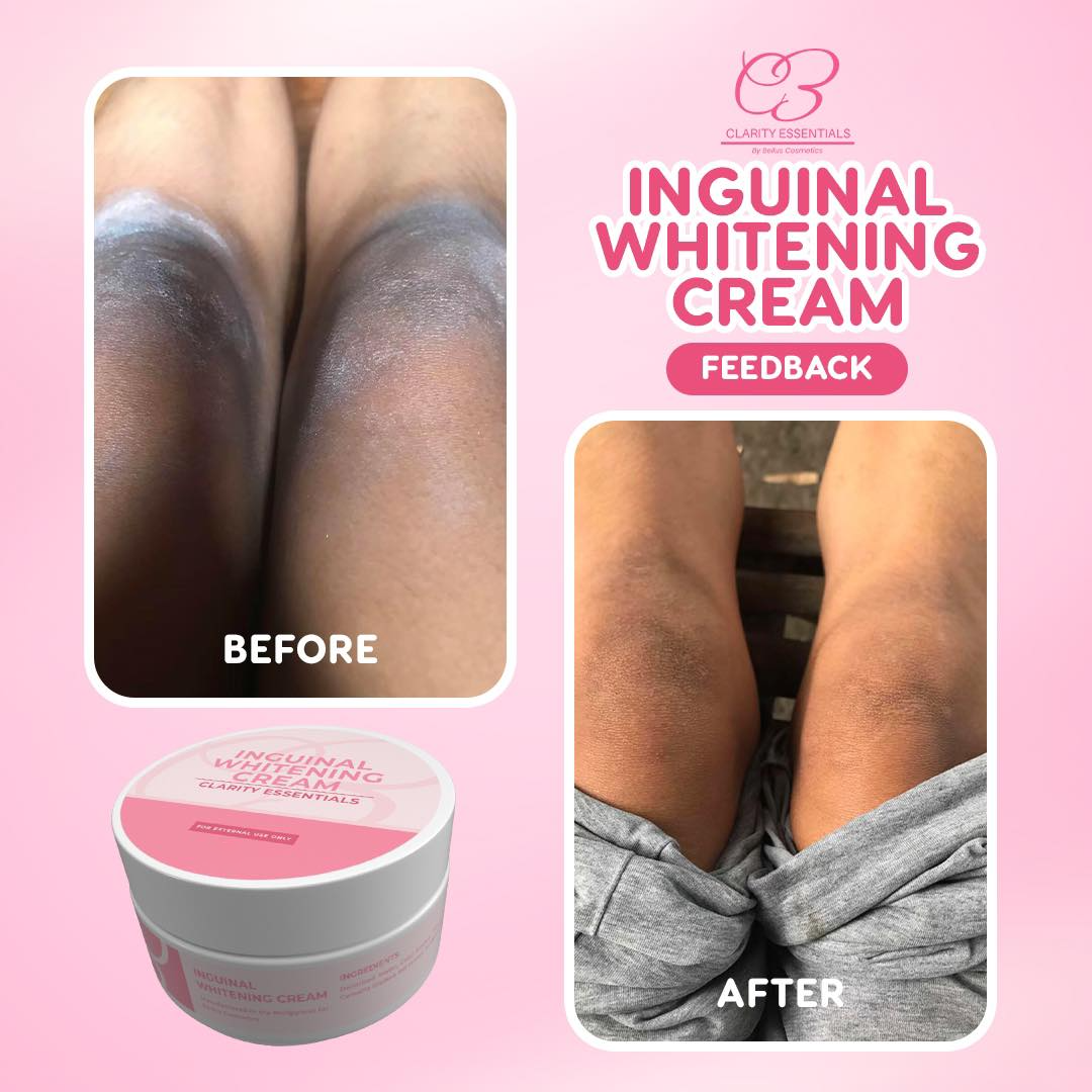 Clarity Essentials Inguinal Brightening Cream - 25g