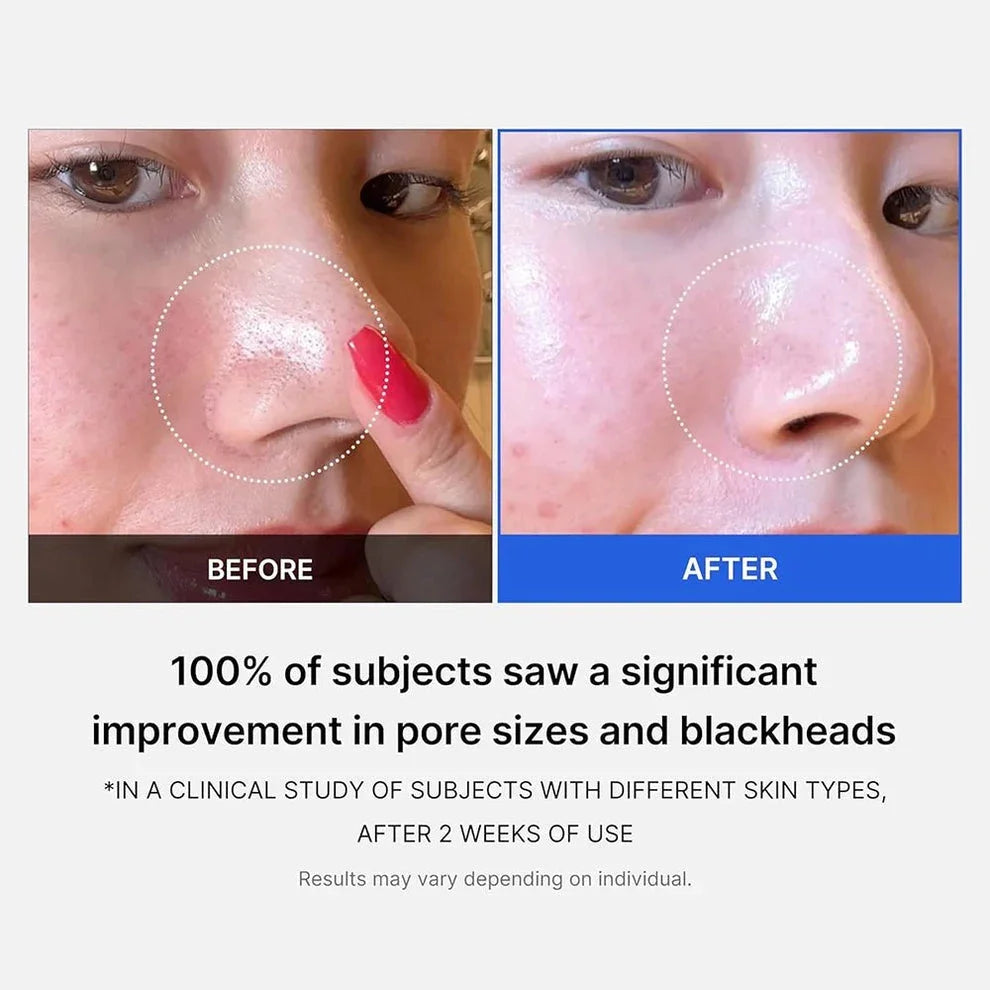 Medicube Zero Pore Cream 2.0 - 50ml
