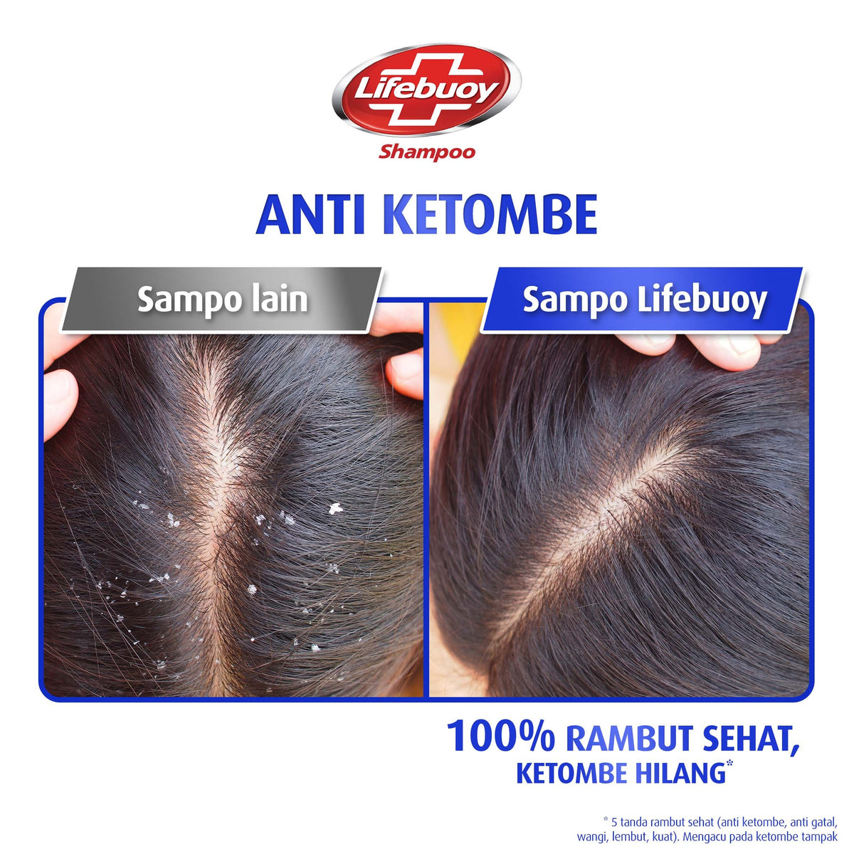 Lifebuoy Anti-Dandruff Shampoo - 680ml