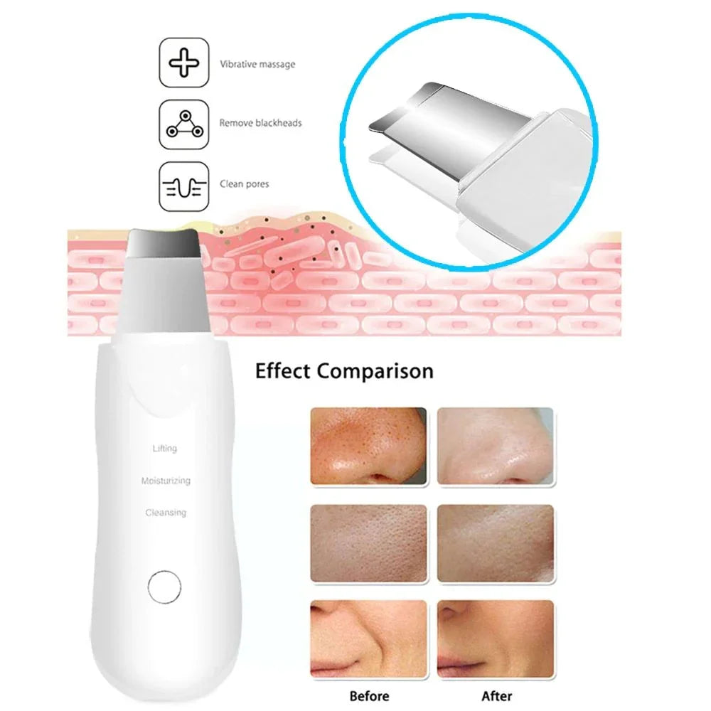 Leather Shovel Moisturizing & Facial Cleanser Machine