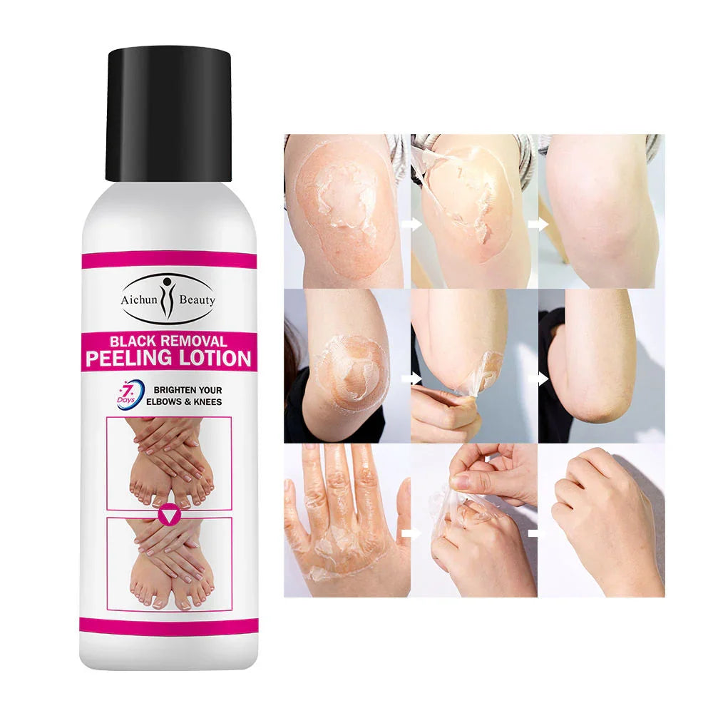 Aichun Beauty Black Removal Brightening Peeling Lotion - 100g