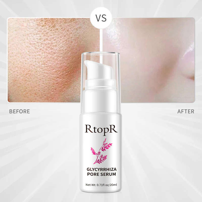 RtopR Glycyrrhiza Pore Face Serum - 20ml