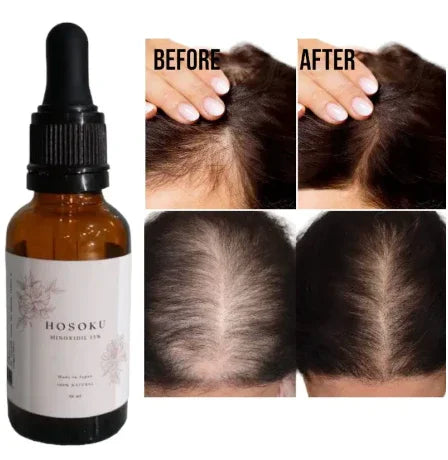 HOSOKU Minoxidil 15% Hair Regrowth Oil - 30ml