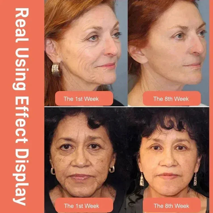 كريم الوجه ريتينول مشيمة الريتينول دم التنين الملكي للوجه - 50غم