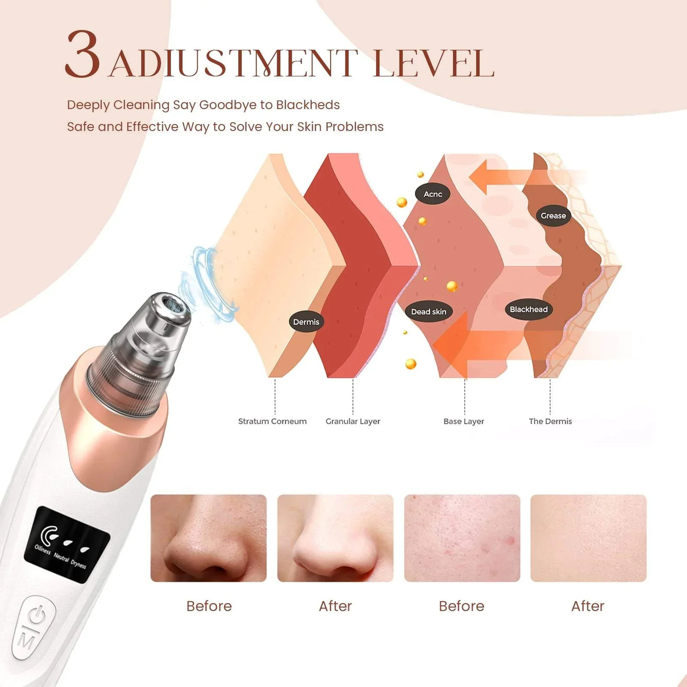Rechargeable Facial Pore Cleaner Kit