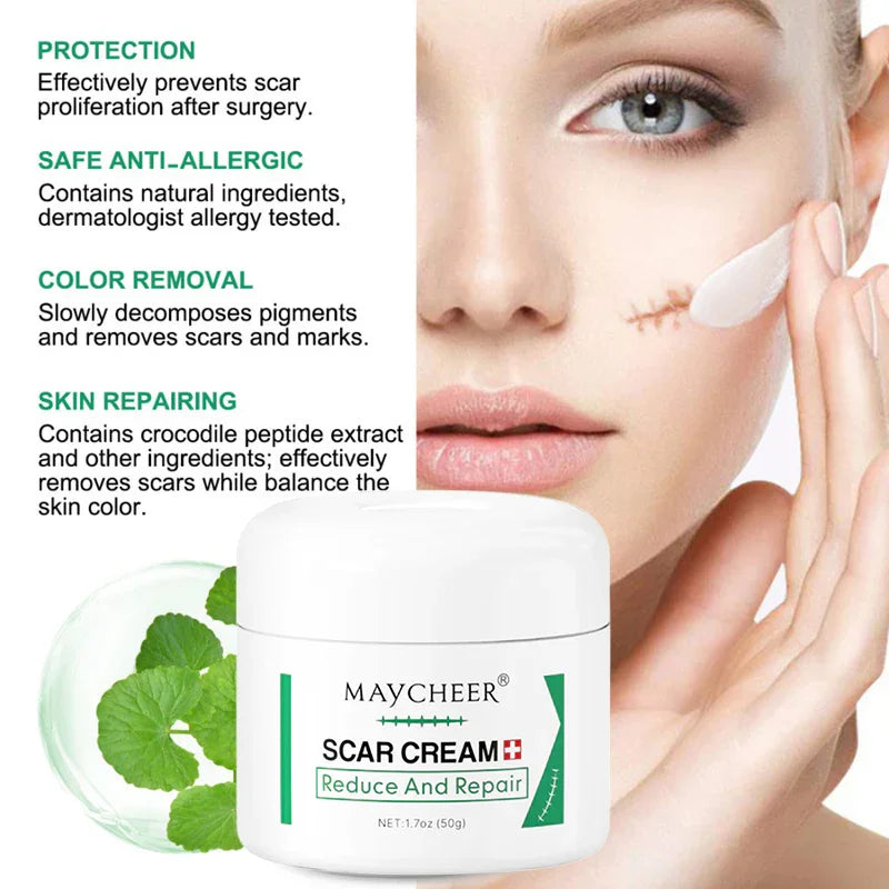 Maycheer Scar Repair & Reduce Cream - 50g