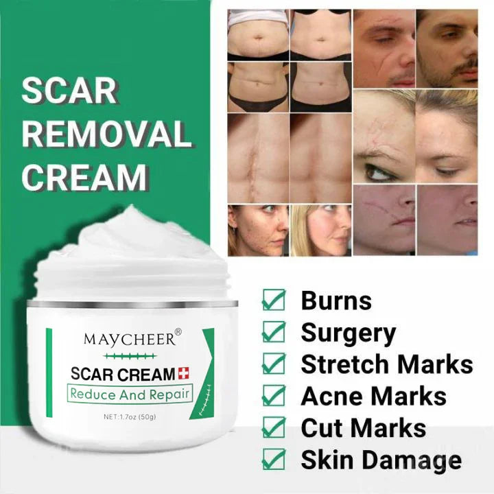 Maycheer Scar Repair & Reduce Cream - 50g