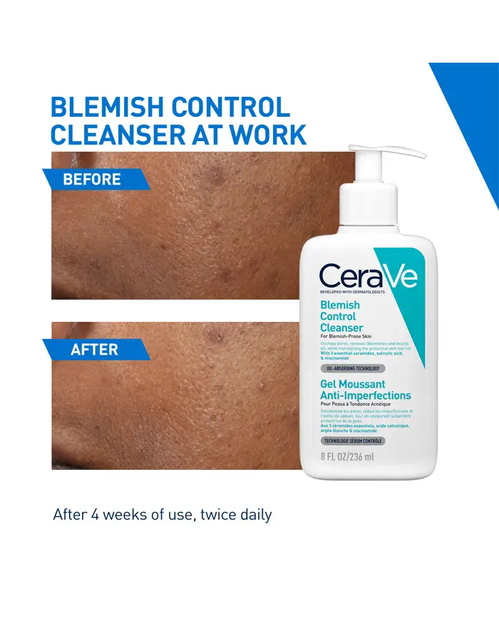 CeraVe Blemish Control Facial Cleanser - 236ml