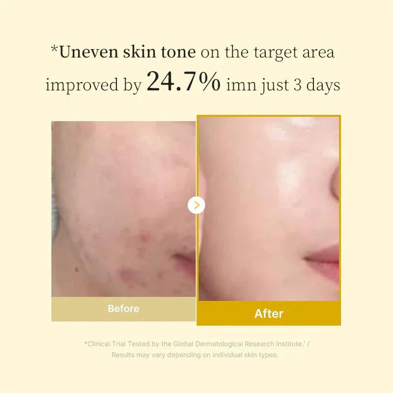 Sadoer Kojic Acid Turmeric Collagen Peel-Off Facial Mask - 75ml
