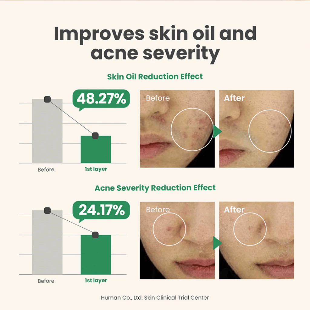 AXIS-Y Spot The Difference Blemish Treatment - 15ml