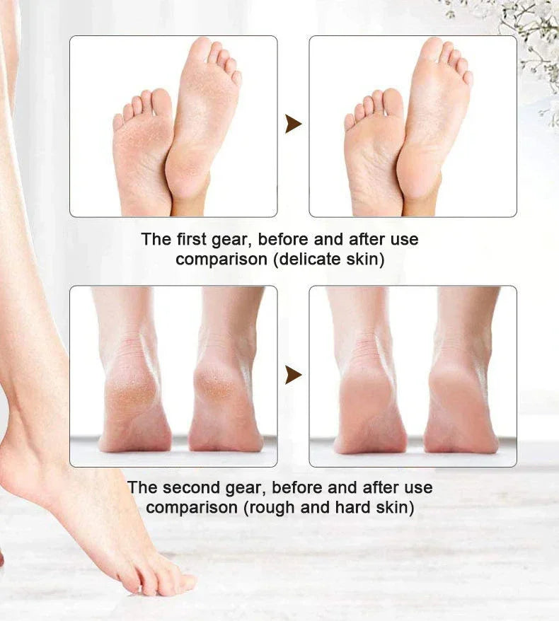 Portable Electric Pedi Callus Remover XG-P8020
