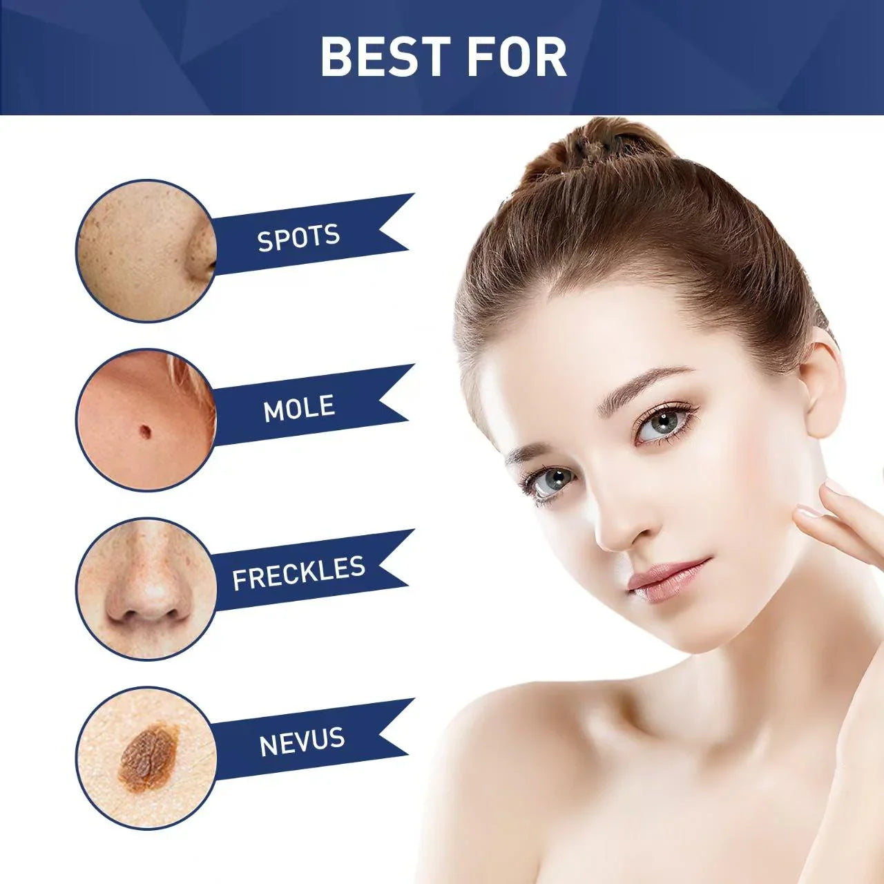 Jaysuing Skin Tag Remover - 20ml